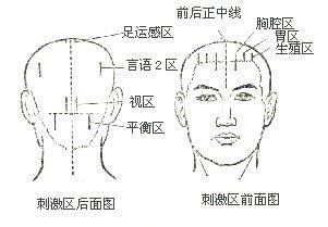 中文名头针疗法 用    途头部进行针刺以治疗各种疾病 理    论脏腑