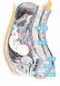 腹腔妊娠是指位于输卵管,卵巢及阔韧带以外的腹腔内妊娠,其发生率约